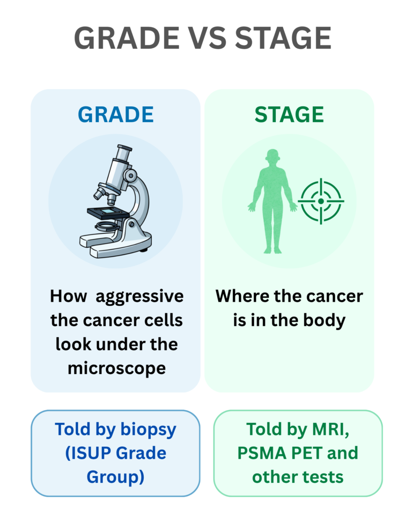 High PSA infographic explaining the difference between prostate cancer grade and stage using biopsy, MRI and PSMA PET