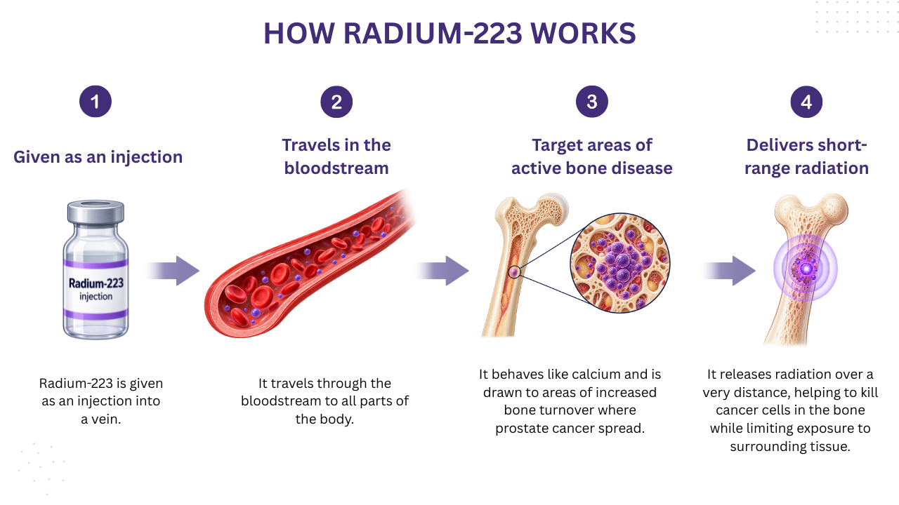 Metastatic prostate cancer Melbourne infographic showing how radium-223 targets prostate cancer in bone