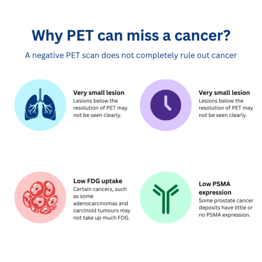 Infographic explaining why a negative PET scan can miss cancer, including small lesions, low FDG uptake and low PSMA expression